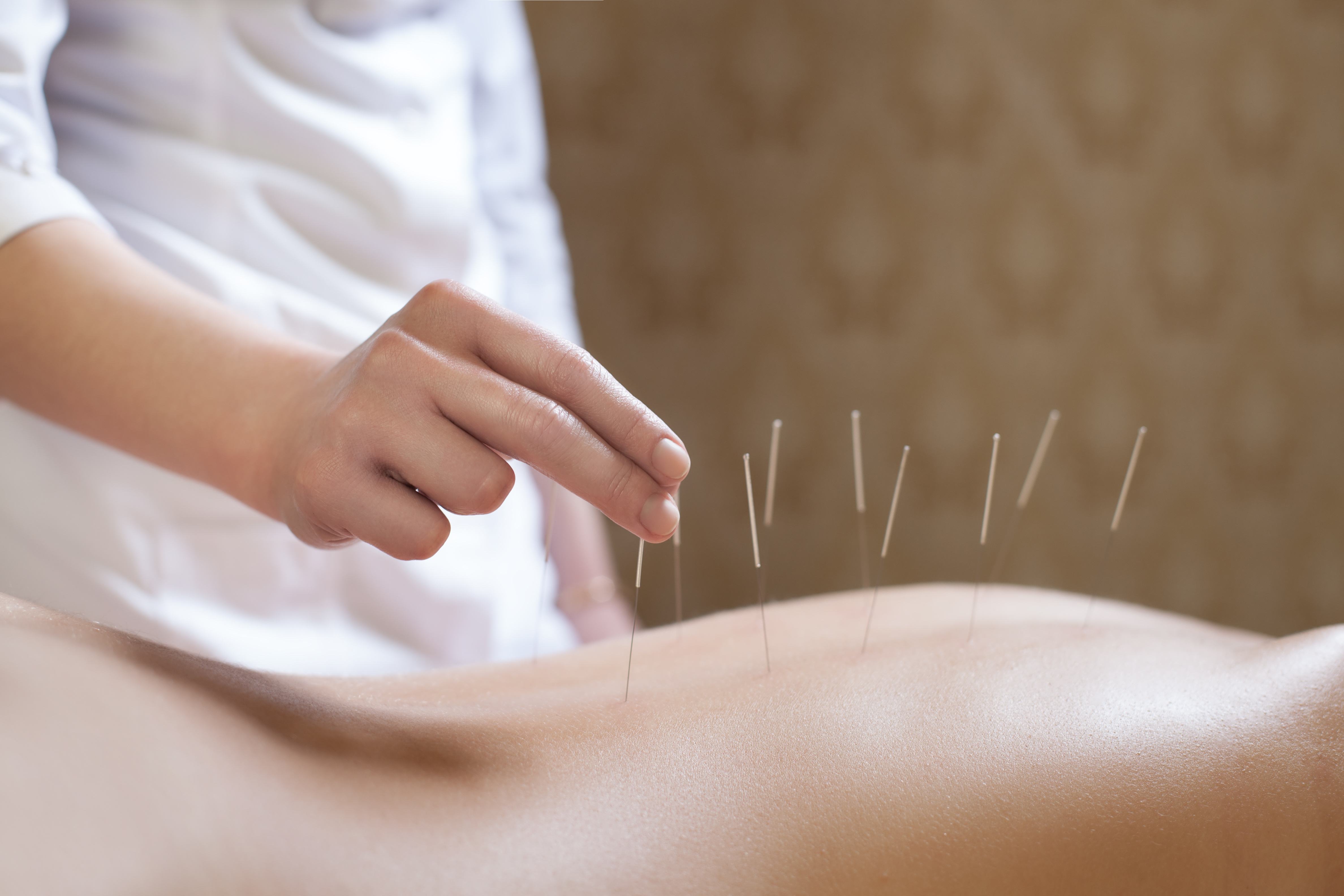 Acupuncture Treatments Bedford